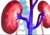 अनियमित खान-पान और जीवनशैली से किडनी की बीमारियां बढ़ीं, चिकित्सकों ने किया सतर्क